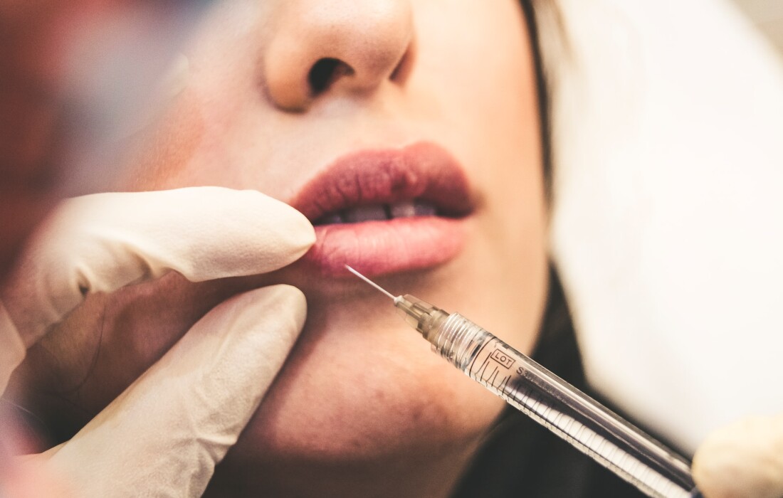 Как происходит удаление филлера из губ – какие препараты используются