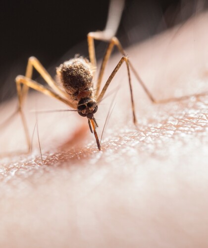 Летняя проблема – что делать после укуса комаров
