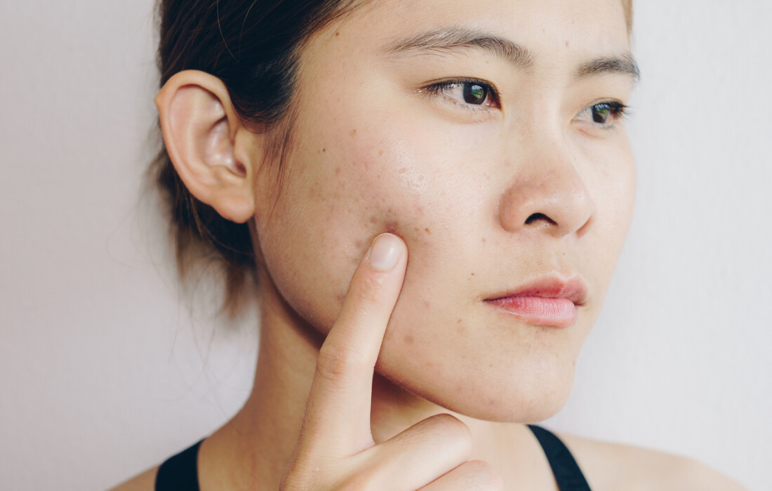 Как скрыть шрам: высокоэффективные приемы макияжа и иные способы