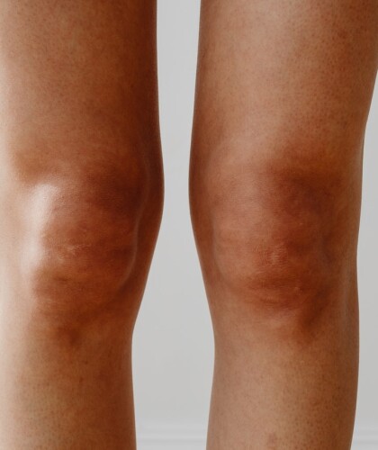 Как предотвратить старение локтей и коленей – рекомендации по уходу за кожей