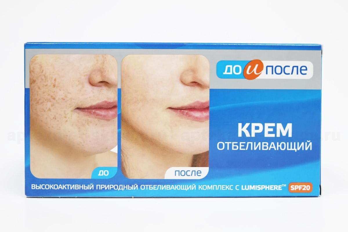 Лучшие отбеливающие средства от пигментных пятен на лице и теле